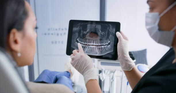 Licensed Tooth Extraction service in Laguna Hills, CA - Smile Center Dentistry